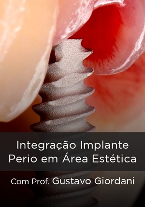 Cover for Integração Implante Perio em Área Estética