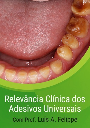 Cover for Relevância Clínica dos Adesivos Universais