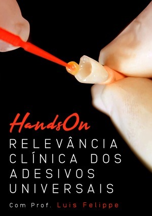 Cover for Hands On: Relevância Clínica dos Adesivos Universais