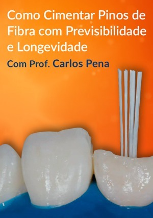 Cover for Como Cimentar Pinos de Fibra com Previsibilidade e Longevidade