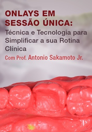 Cover for Onlays em Sessão Única: Técnica e Tecnologia para Simplificar a sua Rotina Clínica