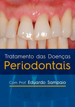 Cover for Tratamento das Doenças Periodontais