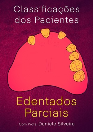 Cover for Classificações dos Pacientes Edentados Parciais