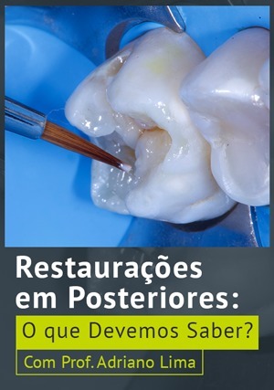 Cover for Restaurações em Posteriores: O que Devemos Saber?
