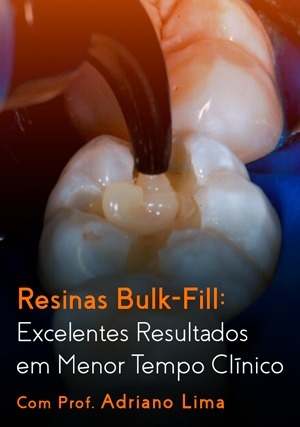 Cover for Resinas Bulk-Fill: Excelentes Resultados em Menor Tempo Clínico