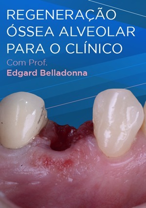 Cover for Regeneração Óssea Alveolar para o Clínico