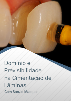 Cover for Domínio e Previsibilidade na Cimentação de Lâminas