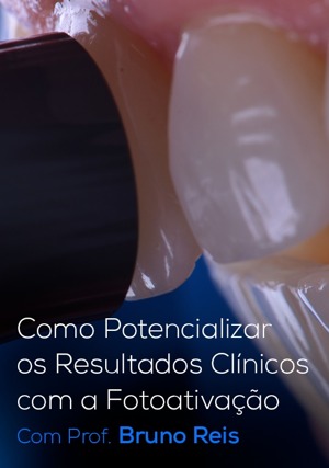 Cover for Como Potencializar os Resultados Clínicos com a Fotoativação
