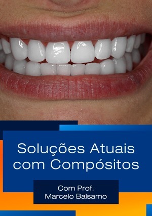 Cover for Soluções Atuais com Compósitos