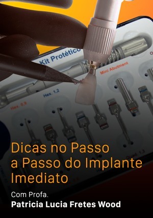 Cover for Dicas no Passo a Passo do Implante Imediato
