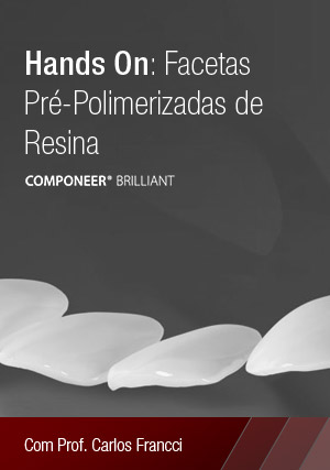 Cover for Hands On: Facetas Pré-Polimerizadas em Resina
