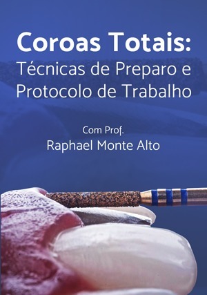 Cover for Coroas Totais: Técnicas de Preparo e Protocolo de Trabalho