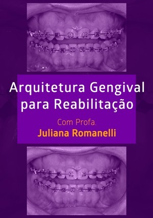 Cover for Arquitetura Gengival Para Reabilitação