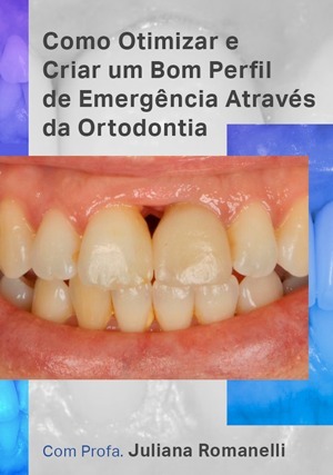 Cover for Como Otimizar e Criar um Bom Perfil de Emergência Através da Ortodontia