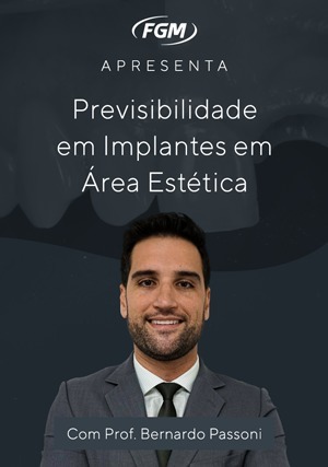 Cover for Previsibilidade em Implantes em Área Estética