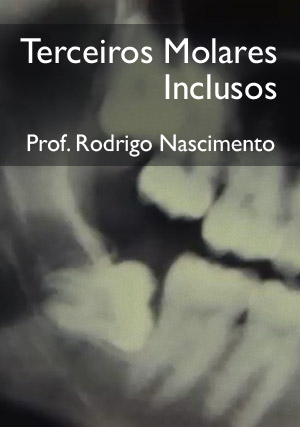 Cover for Terceiros Molares Inclusos