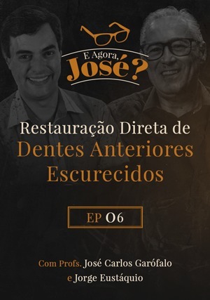 Cover for E agora, José? Restauração Direta de Dentes Anteriores Escurecidos