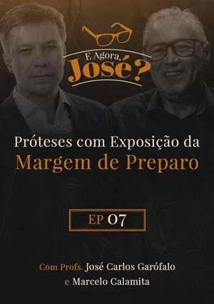 Cover for E Agora, José? Próteses com Exposição da Margem de Preparo
