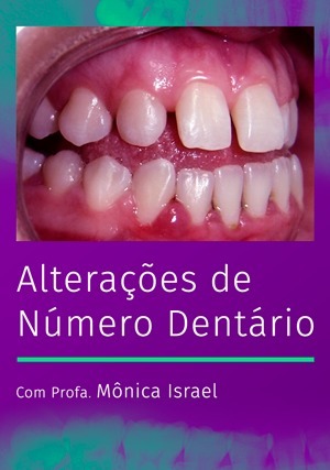 Cover for Alterações de Número Dentário