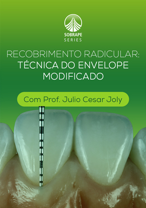 Cover for Recobrimento Radicular: Técnica do Envelope Modificado