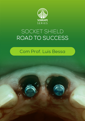 Cover for Socket Shield: Road to Success