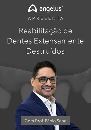 Cover for Reabilitação de Dentes Extensamente Destruídos