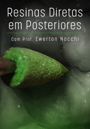 Cover for Resinas Diretas em Posteriores