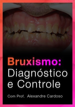 Cover for Bruxismo: Diagnóstico e Controle