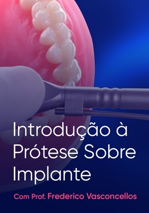Cover for Introdução à Prótese Sobre Implante