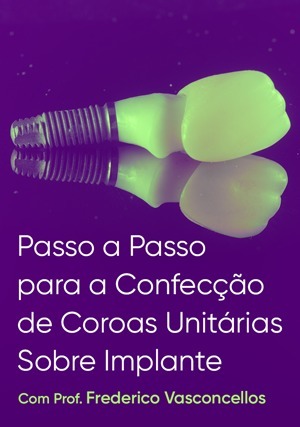Cover for Passo a Passo para a Confecção de Coroas Unitárias Sobre Implante
