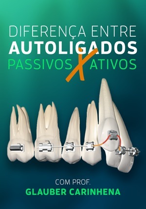 Cover for Diferença entre Autoligados Passivos e Ativos