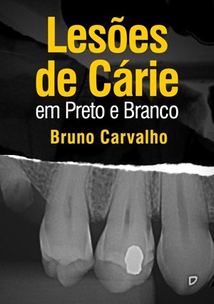 Cover for Lesões de Cárie em Preto e Branco