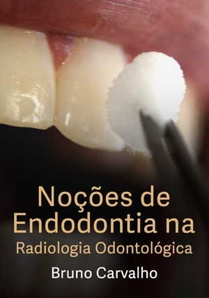 Cover for Noções de Endodontia na Radiologia Odontológica