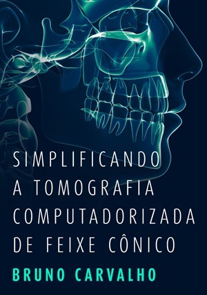 Cover for Simplificando a Tomografia Computadorizada de Feixe Cônico