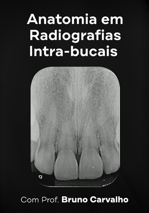 Cover for Anatomia em Radiografias Intrabucais