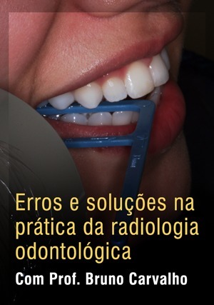 Cover for Erros e soluções na prática da radiologia odontológica
