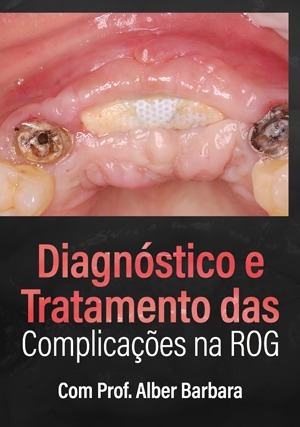 Cover for Diagnóstico e Tratamento das Complicações na ROG