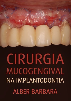 Cover for Cirurgia Mucogengival na Implantodontia