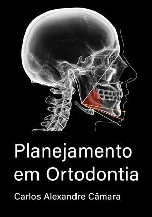 Cover for Planejamento em Ortodontia