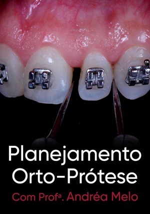 Cover for Planejamento Orto-Prótese
