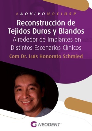 Cover for Reconstrucción de Tejidos Duros y Blandos Alrededor de Implantes en Distintos Escenarios Clínicos