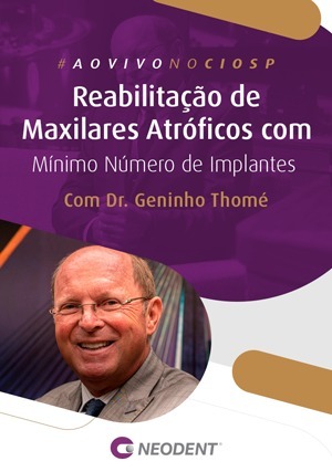 Cover for Reabilitação de Maxilares Atróficos com Mínimo Número de Implantes Dentários