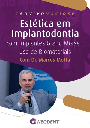Cover for Estética em Implantodontia com Implantes Grand Morse - Uso de Biomateriais