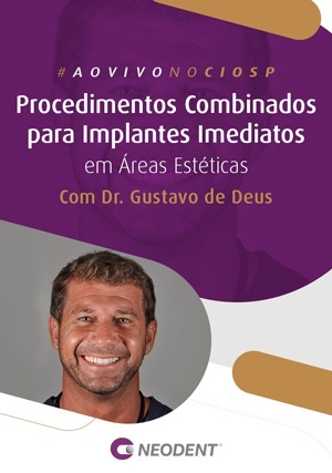 Cover for Procedimentos Combinados para Implantes Imediatos em Áreas Estéticas