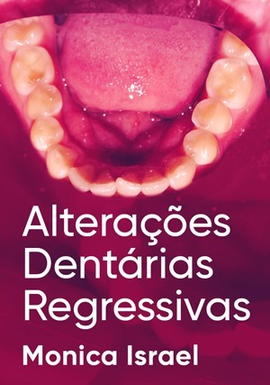 Cover for Alterações Dentárias Regressivas