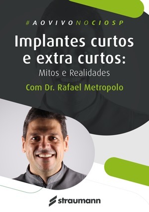 Cover for Implantes curtos e extra curtos: Mitos e Realidades