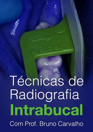 Cover for Técnicas de Radiografia Intrabucal