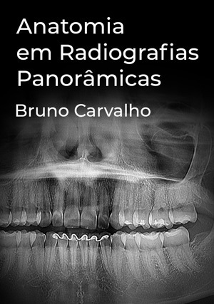 Cover for Anatomia em Radiografias Panorâmicas
