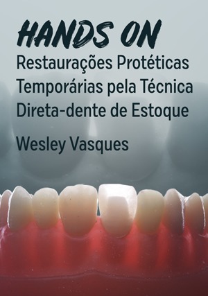 Cover for Hands On: Restaurações Protéticas Temporárias pela Técnica Direta - Dente de Estoque