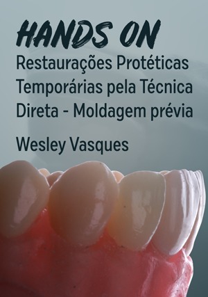 Cover for Hands On: Restaurações Protéticas Temporárias pela Técnica Direta - Moldagem Prévia